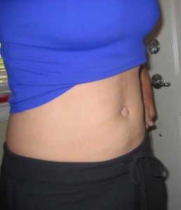 My stomach in September, 2008.