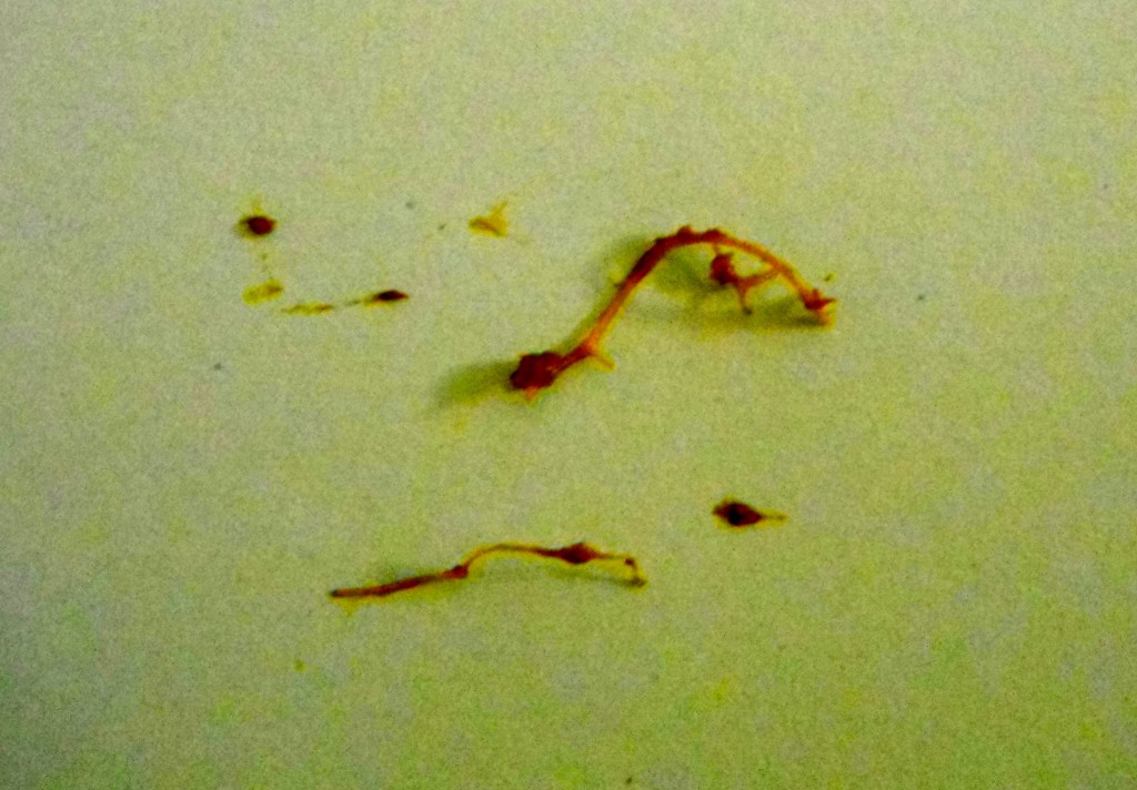 These parasites are what one mom found in her toddler's diaper after giving her bentonite clay.